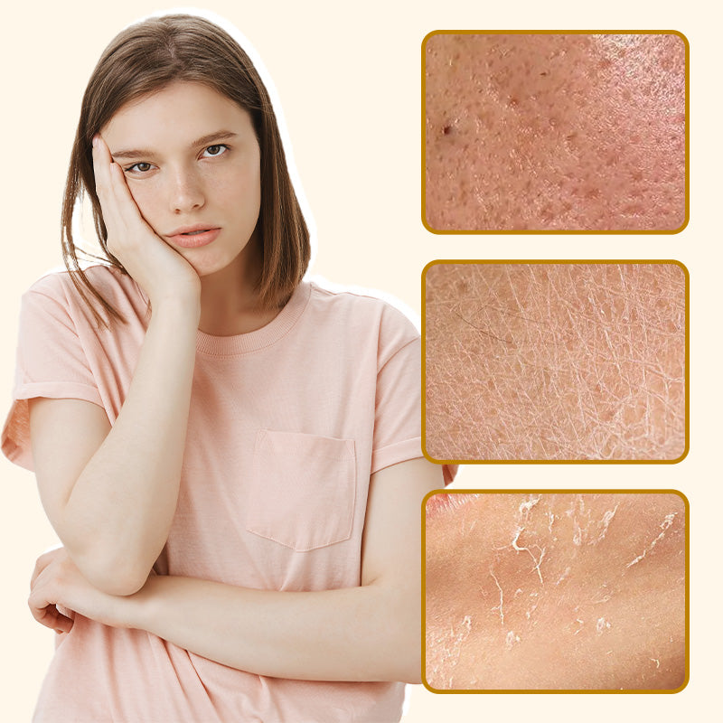 ⏰ ΤΕΛΕΥΤΑΙΑ ΜΕΡΑ 50% ΕΚΠΤΩΣΗ👩‍⚕️Ολοκληρωμένη Κρέμα με Δηλητήριο Μέλισσας